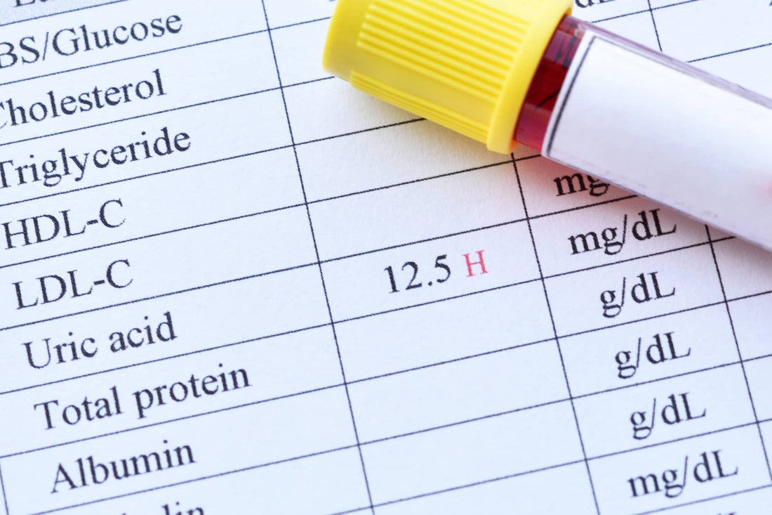 How this simple lab test can reveal the cause of your fatigue…and your weight gain