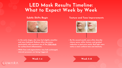 Lumara VISO Red Light Mask